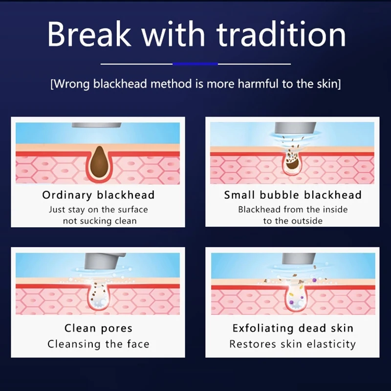 Уход за кожей Blackhead дропшиппинг по сниженной цене лица глубокие поры акне
