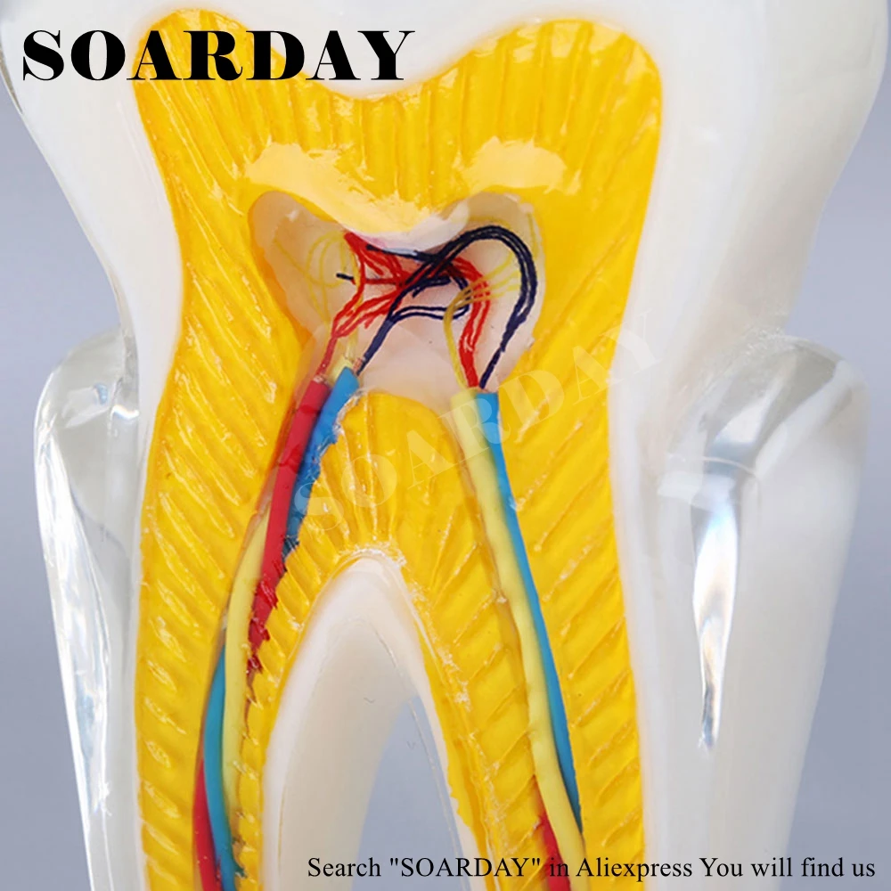 SOARDAY шестикратная модель анатомии зубного нерва патологическая