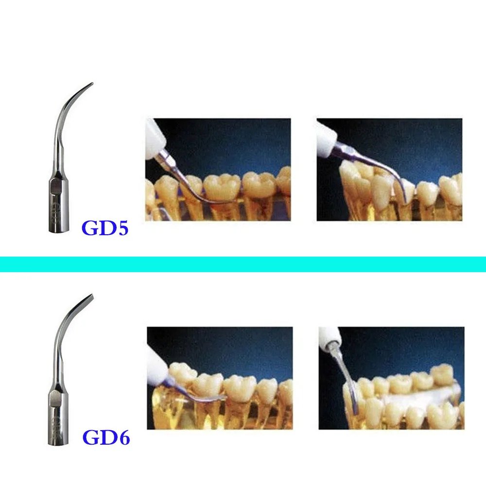 6 шт./компл. стоматологический ультразвуковой скалер наконечник GD1 GD2 GD3 GD4 GD5 GD6 для
