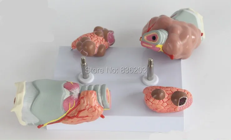 Thyroid Diseas of Human Head Neck Model in trauma anatomy skeleton dental anatomical shadow brain skullmedical training manikins |