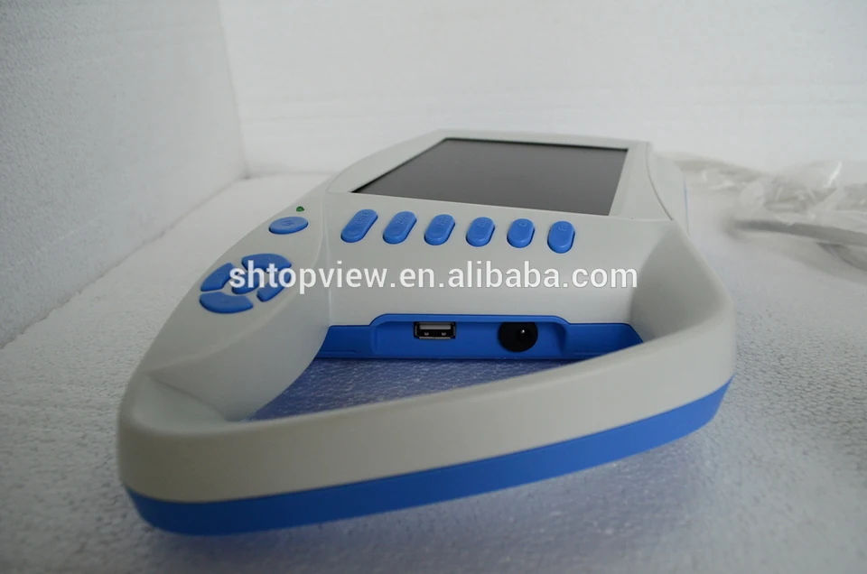 Ecnomic ATNL51353C полный цифровой Palmtop человек ветеринар многофункциональный 7 дюймов ручной портативный сканер