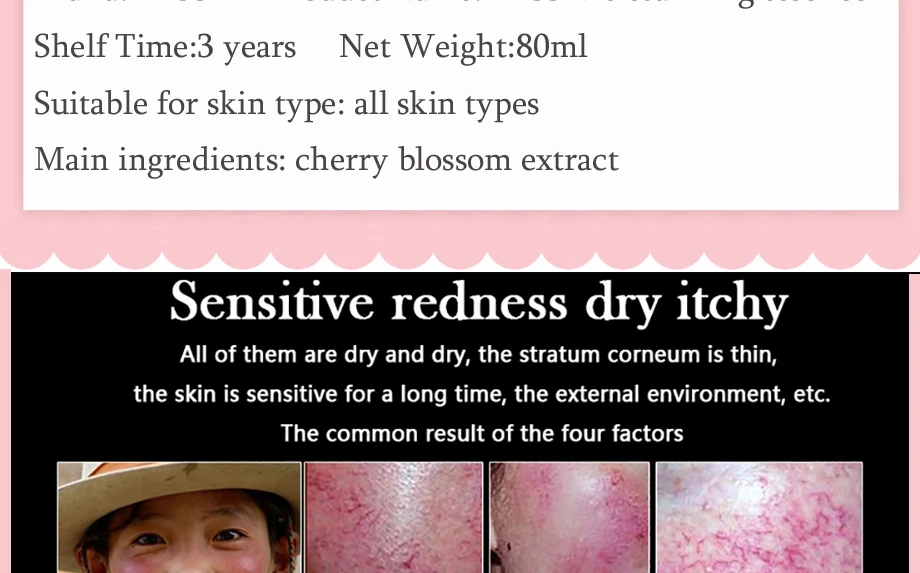 YASS Cherry Blossom сыворотка натуральная и Органическая уменьшает морщины и осветляет темные пятна темный круг, тонкая линия и солнцезащитный корректор