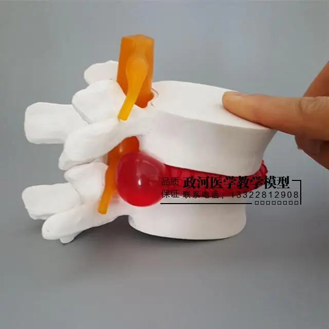 Медицинская человеческая поясница дисковая Презентация модель ортопедического