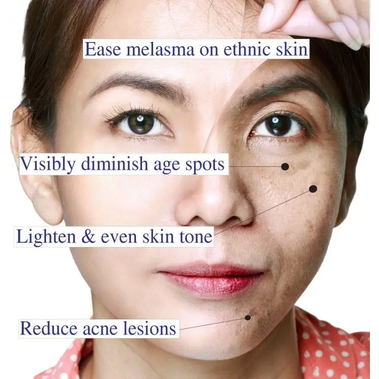 Гликолевая кислота 30% Восстанавливающий пилинг отшелушиватель чистый AHA