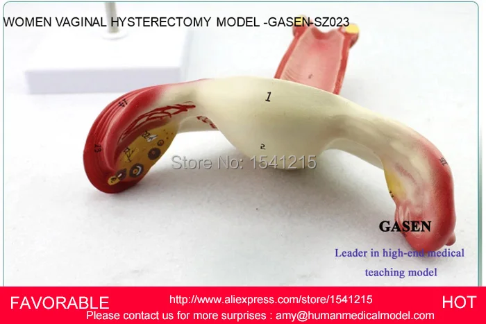 Модель матки модель генитальной анатомии учебная медицинская планирования