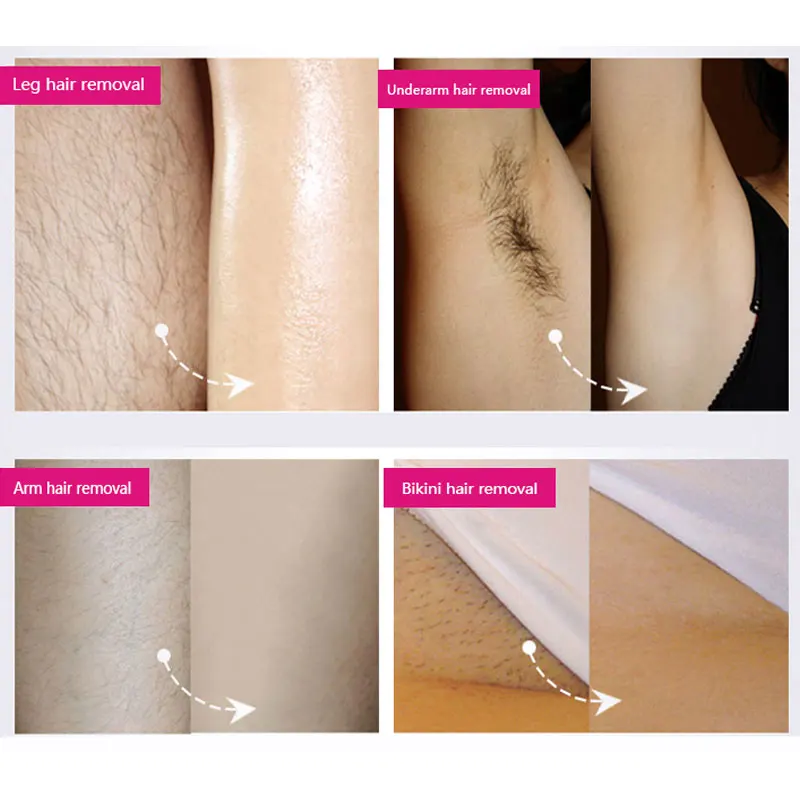 DR RASHEL лимон крем для удаления волос жожоба масло Ноги подмышек бикини линия