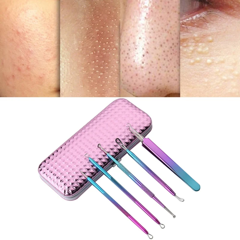 5pcs/Bag Acne Needle Set Pore Spot Cleaner Blackhead&ampBlemish Pimples Removers Blackhead Tweezers Face Skin Care Tools | Красота и