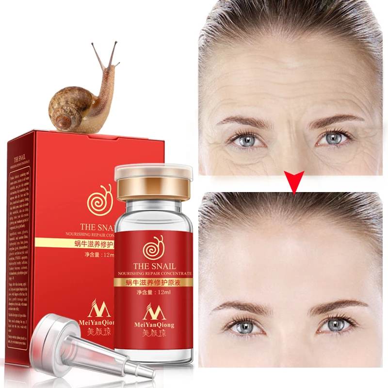 Отбеливающий крем для лица от акне лечение гиалуроновой кислоты удаление морщин