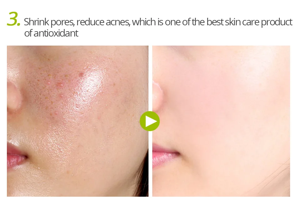 VG Resveratrol конденсационный крем увлажняющий и защищающий опреснительные пятна