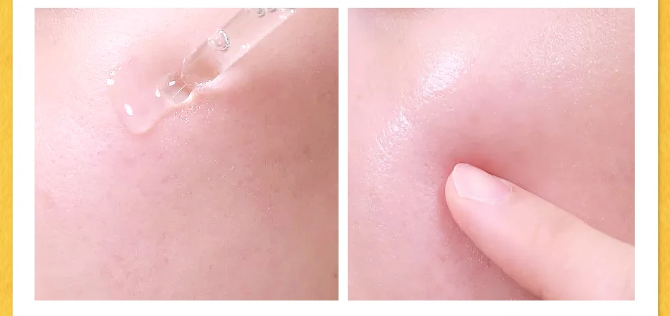 OMYLADY Replenishment Tender Liquid Skin Care Face Care Day Cream Anti-Winkle essence Hyaluronic Acid Moisturizing