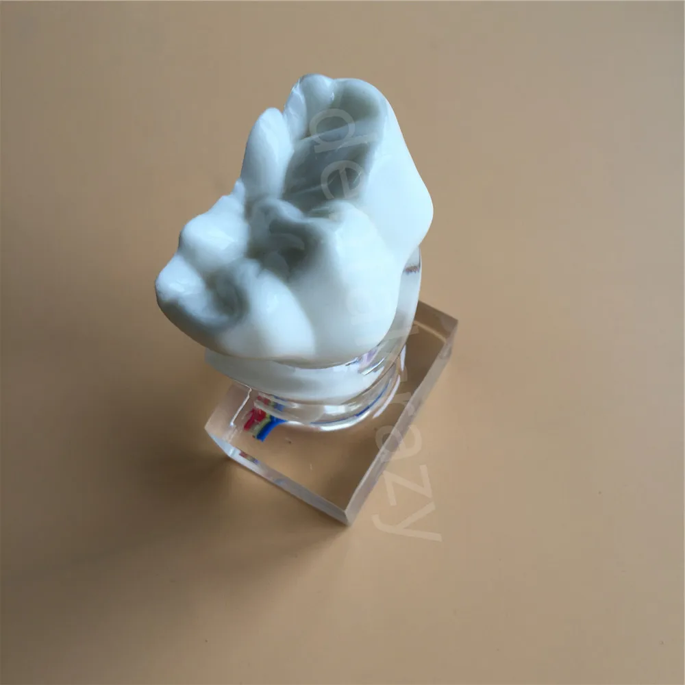 Dental Anatomical Molar Model molar inner structure with nerves and vessels Teeth 2018 | Красота и здоровье