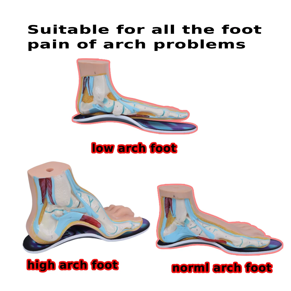 2 pair/lot Premium Orthotic Gel High Arch Support Insoles Gel Heel Pad 3D Arch Support Plantar Fasciitis Supports Men and Women