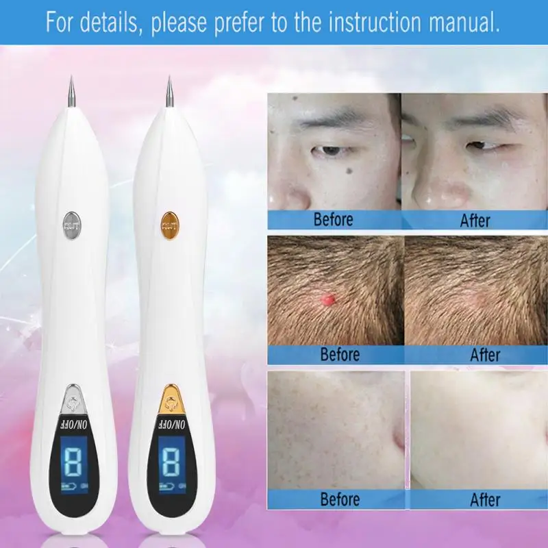 USB перезаряжаемая плазменная ручка для удаления Кротов средство темных пятен ЖК