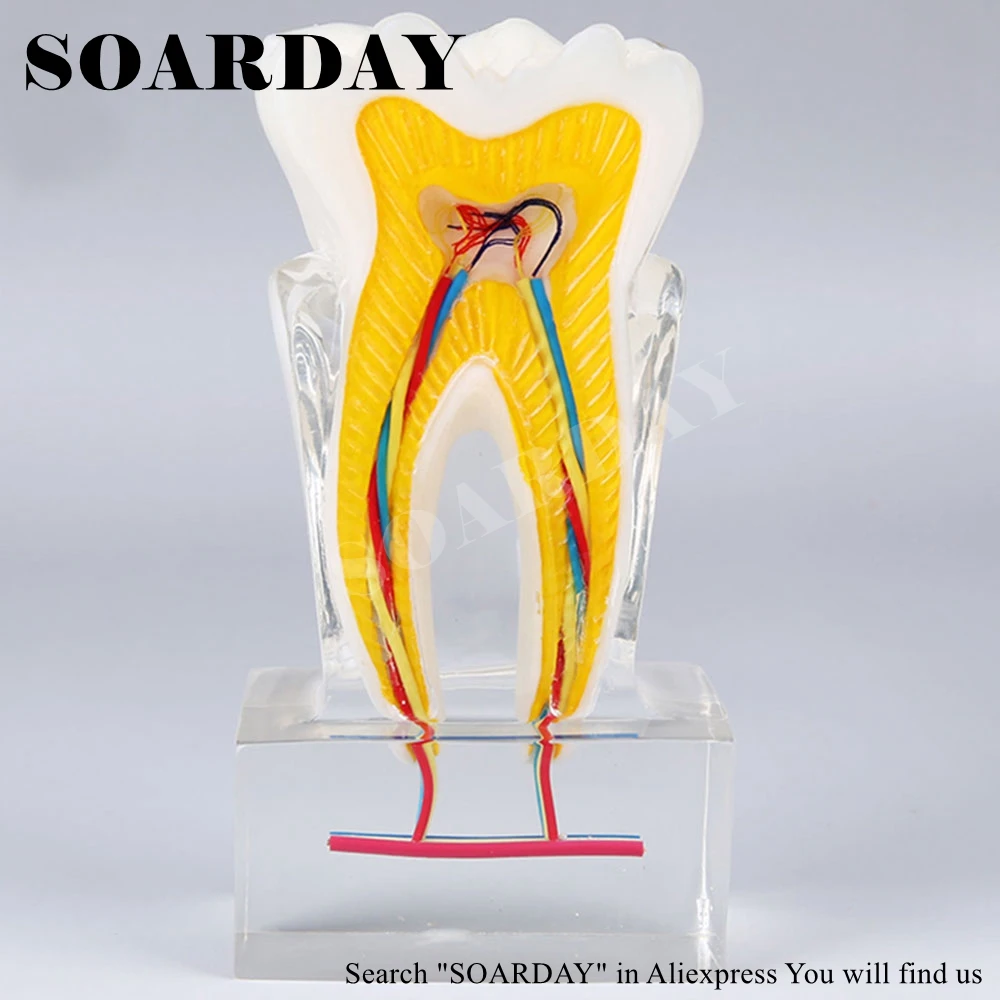 SOARDAY шестикратная модель анатомии зубного нерва патологическая