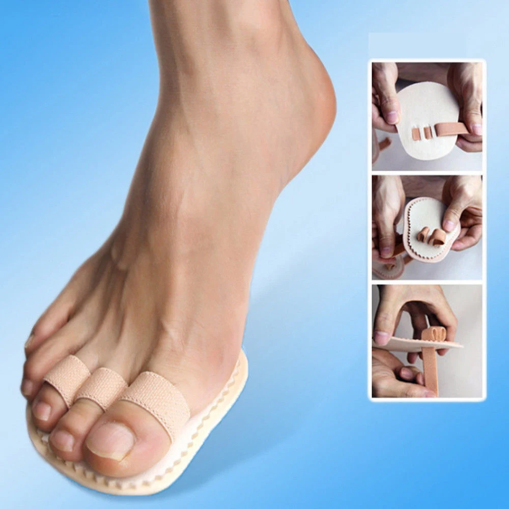 Hallux плюсневый кривой ортопедический вальгусный унисекс инструмент для ухода за
