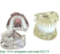 

Free Shipping Natural size mode(removable) crystal dental tooth teeth dentist dentistry anatomical anatomy model odontologia