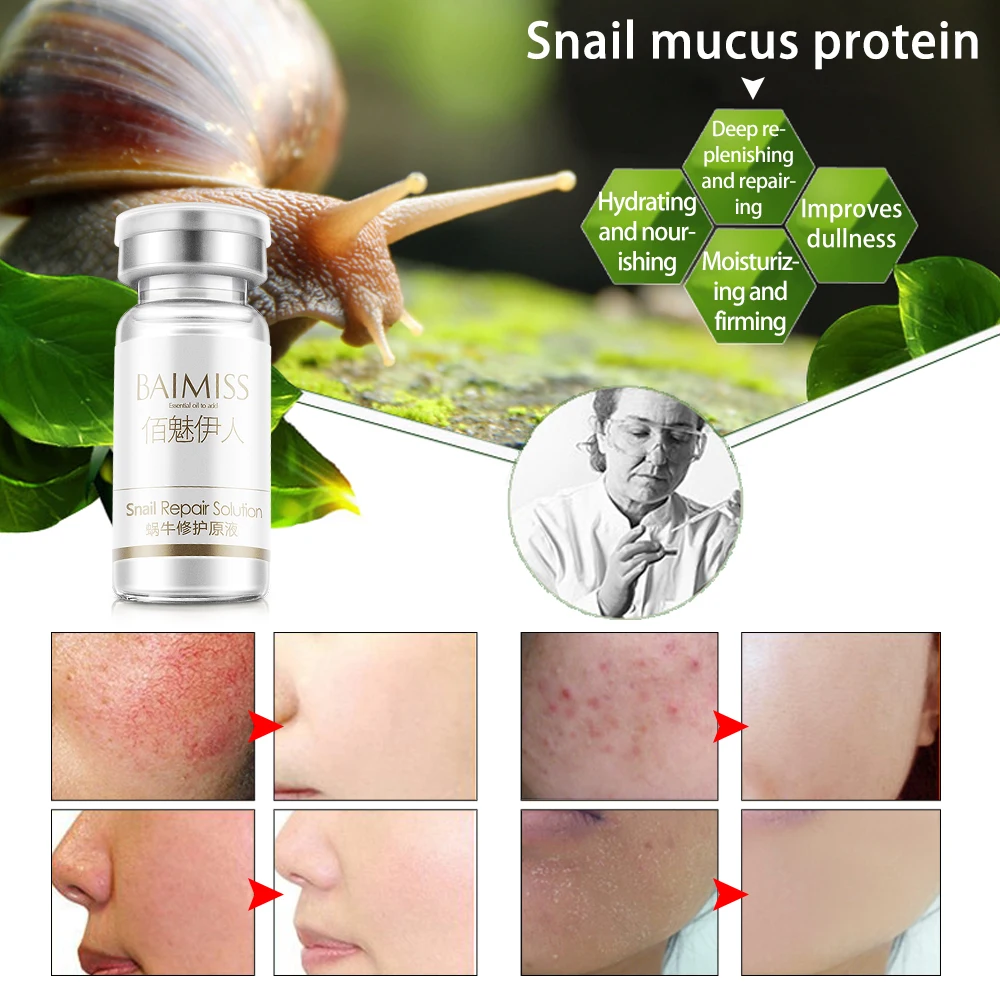 BAIMISS сыворотка для восстановления улитки уход за лицом лечение акне удаление