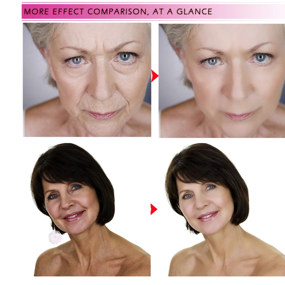 

Pure Retinol Vitamin A 2.5% Hyaluronic Acid Facial Serum Face Cream 15ml 24K Golden Mask Anti Wrinkle Anti Aging Facial Mask