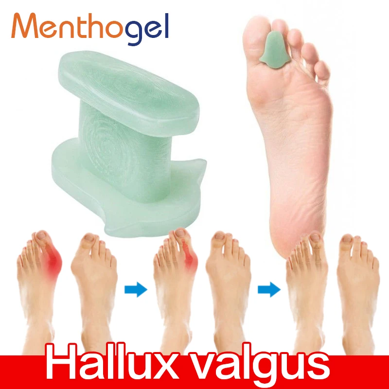 Menthogel Hallux Valgus Correction Feet Care Special Big Toe Bone Silicone Foot Thumb Orthopedic Brace Relieve Inch Pain | Красота и