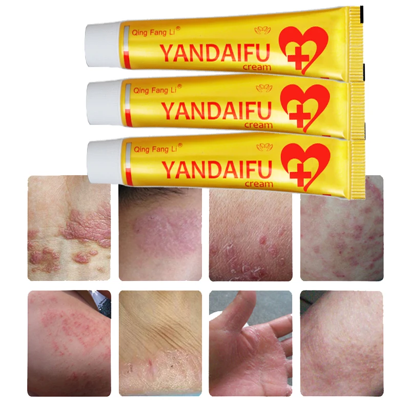 20 шт YANDAIFU натуральный травяной псориаз экзема крем zudaifu дерматит eczema Pruritus для
