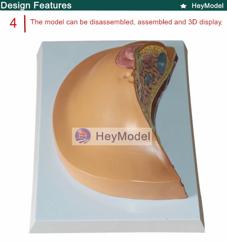 Heymodel женской груди поражений модель