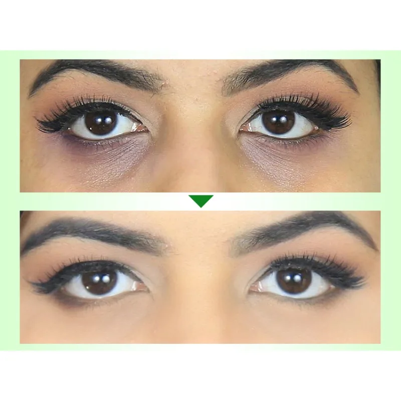 

Eye Cream Bright And Detailed Moisturizing Ageless Anti Wrinkle Firming For Dark Circles Puffiness Wrinkles Bags