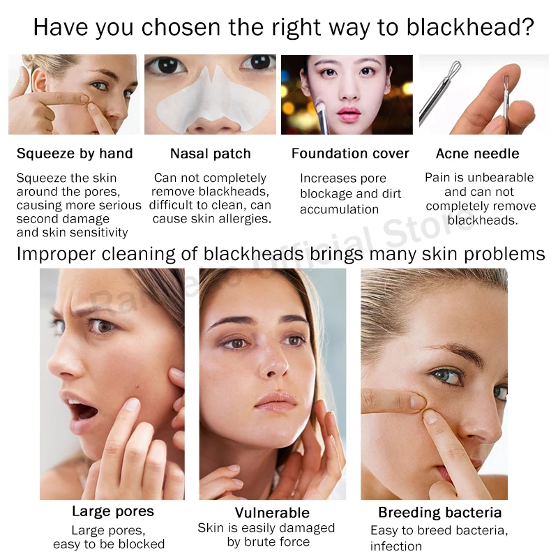 Дермабразия машина Blackhead пылесос всасывание удаление для постугревых рубцов