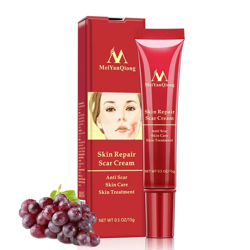 

Acne Scar Stretch Marks Remover Cream Skin Repair Face Cream Acne Spots Acne Treatment Blackhead Whitening Cream 15g