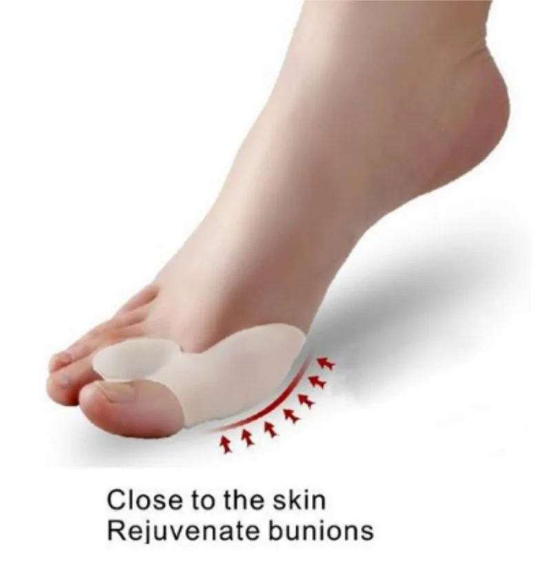Гель инструмент для ухода за ногами корректор Bunion Bone Hallux вальгусный выпрямитель