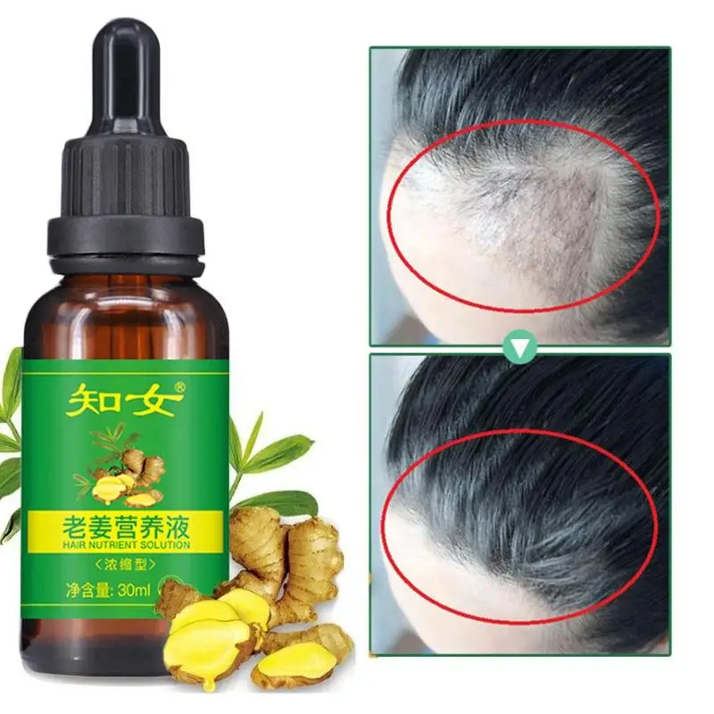 30ml Ginger Hairdressing Hairs Mask Hair Essential Oil Care Dry and Damaged Nutrition | Красота и здоровье
