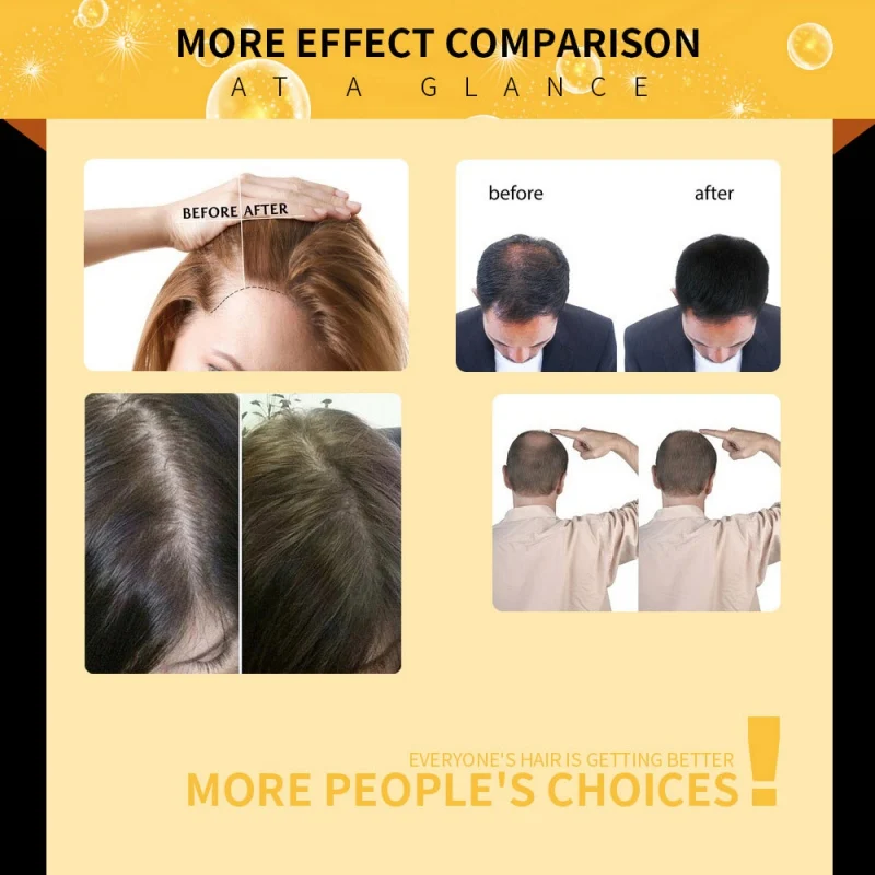 2019 натуральный чистый оригинальный Эфирное Масла средство для роста волос