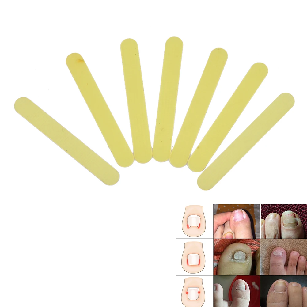 1Pc Ingrown Toe Nail Correction Sticker Patch Paronychia File Acronyx Wire Corrector Foot Care Tool | Красота и здоровье