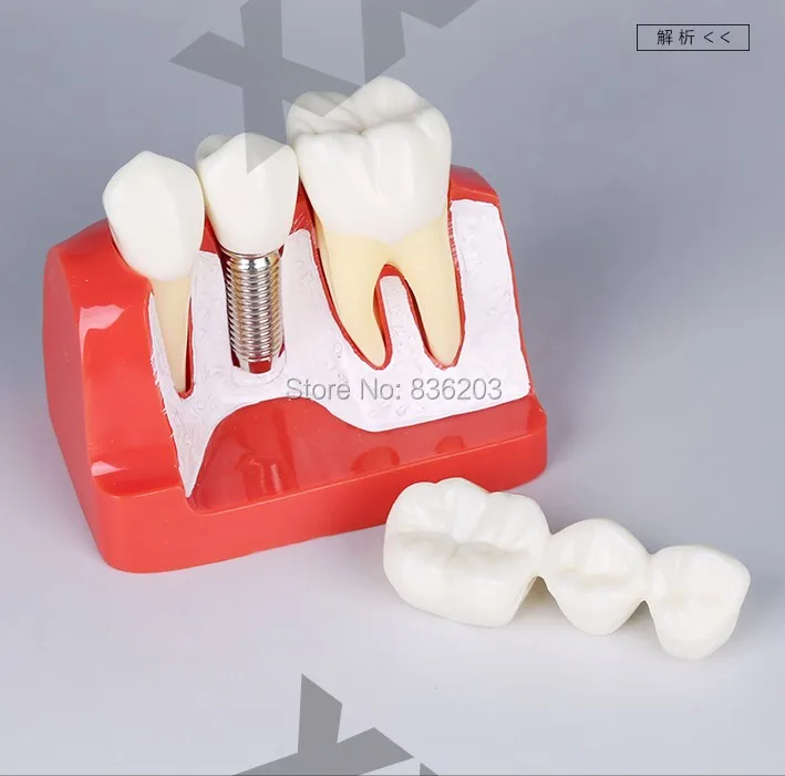 Стоматологическое лабораторное оборудование отбеливание зубов гигиена полости