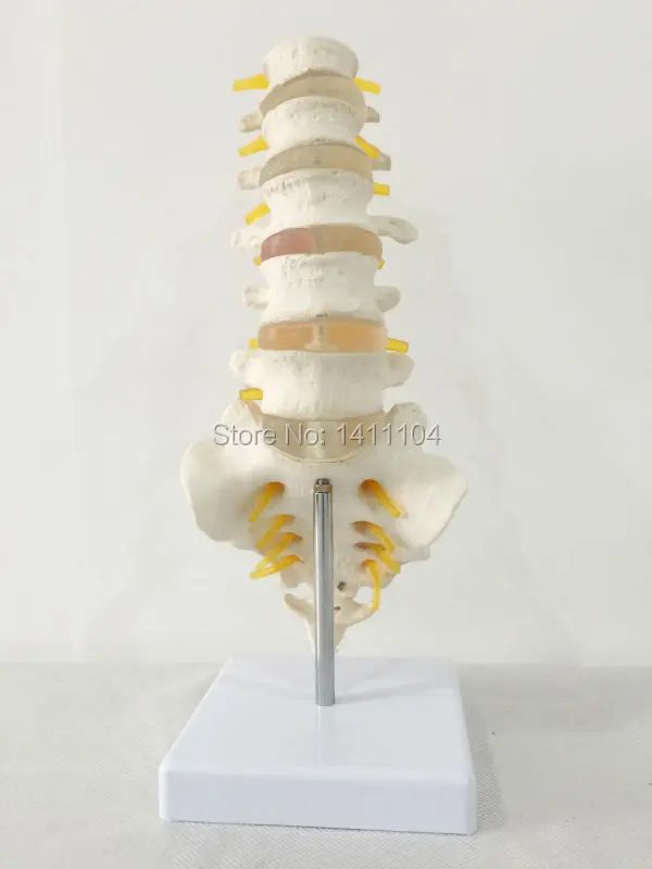 Бесплатная доставка и 5 поясничных крестцовых позвонков с креплением к нервам