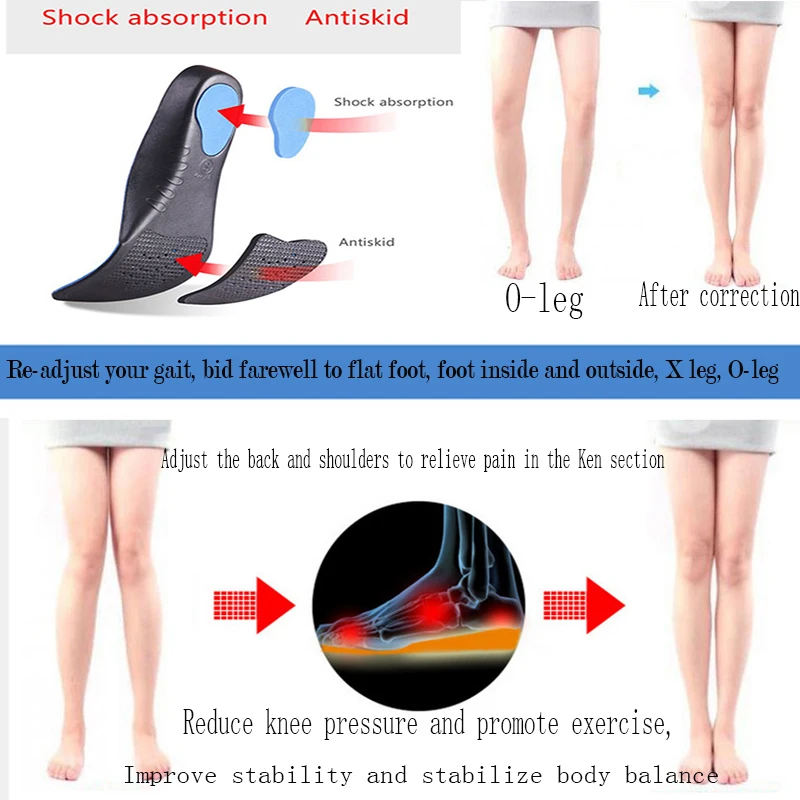 Ортопедические InsolesFlatfoot ортопедические Cubitus Varus ортопедические стельки для ухода за ногами унисекс дезодорирующие стельки