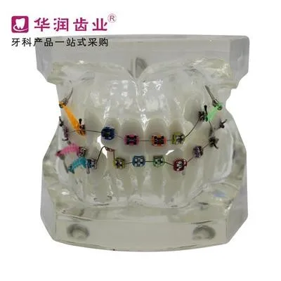

Dentistry teeth Orthodontic model Patient communication model free shipping