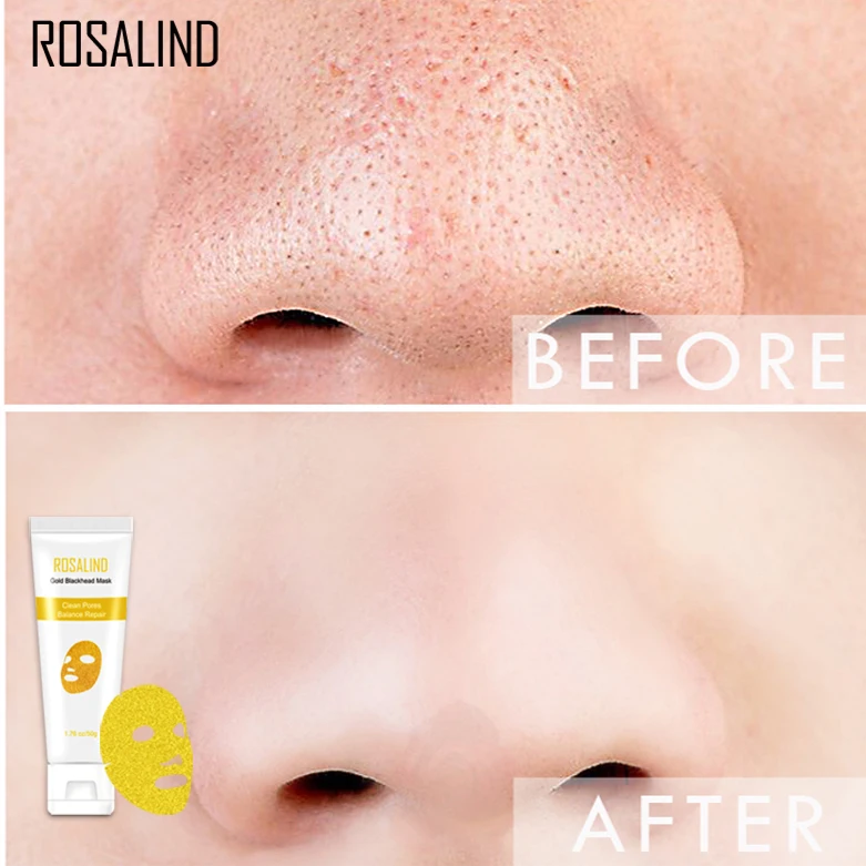 ROSALIND маска для лица 24K золото коллаген удаления угрей против старения Усадочные