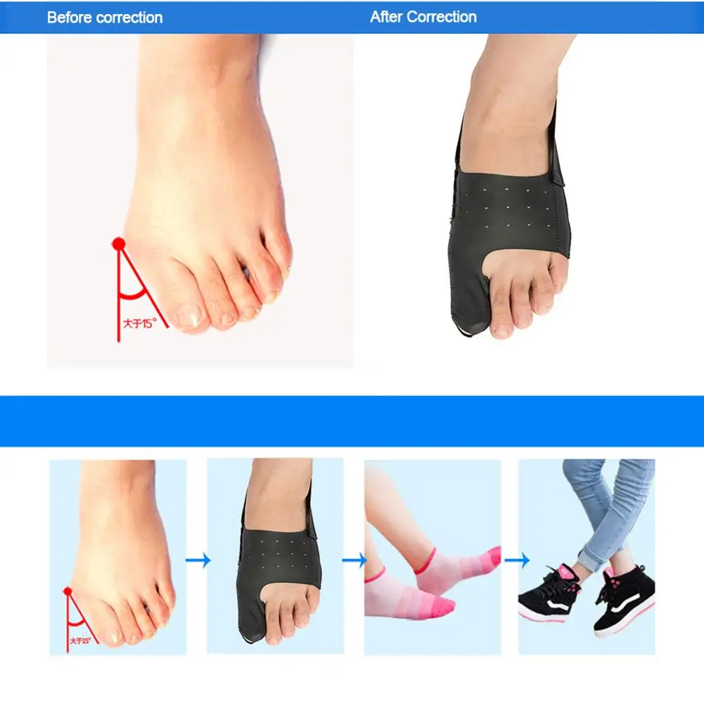Корректор Bunion комплект для сброса бунионов Bunion Splints гелевая защита для пальцев ног сепаратор рукава разделители для ног хорошее качество удобные