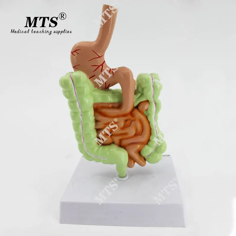 Желудочно кишечная патология человека MTS анатомическая модель пищеварения