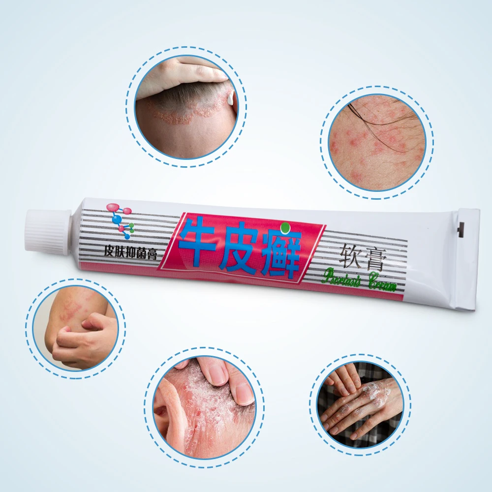 Psoriasis Creams Body Pain Relief Herbal Eczema Ointment Pruritus Dermatitis Itching Plaster Skin Care 20g P1017 | Красота и здоровье