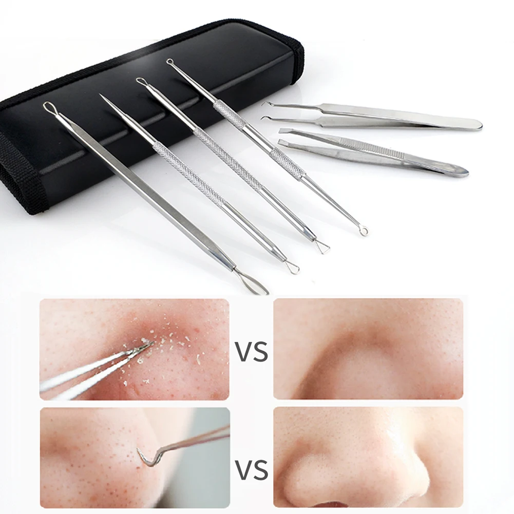 6pcs Facial Removal Blackhead Remover Skin Care Set Stainless Steel Comedone Double-Headed Pimple Acne Needles Tweezer | Красота и