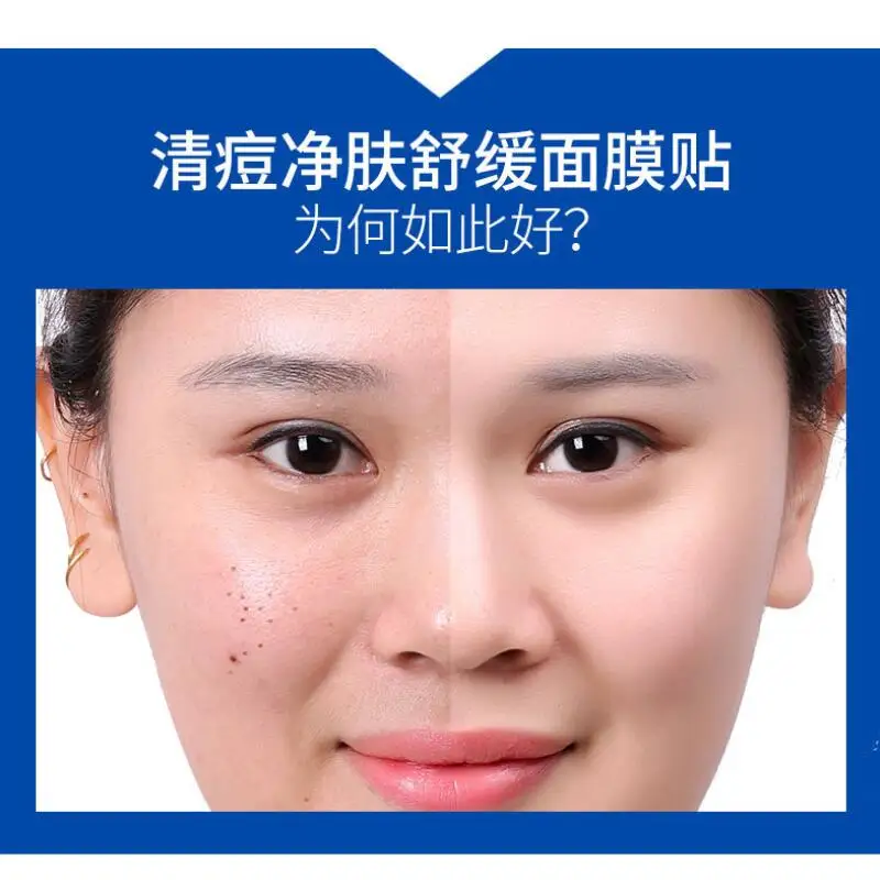 Маска OneSpring для лечения акне Отбеливающая увлажняющая маска лица с контролем