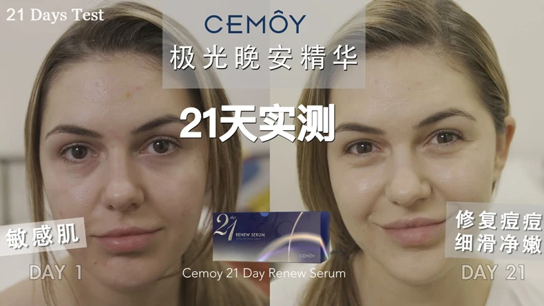 Cemoy 21 день обновление сыворотка 2 мл X 21 пачки лицо Ночная сывороточная эссенция Reapir дневные повреждения