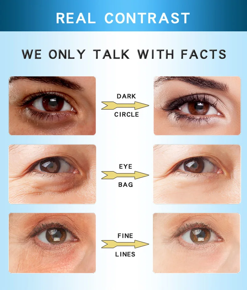 Mango против морщин для ухода за областью вокруг глаз уход кожей отёков тёмных