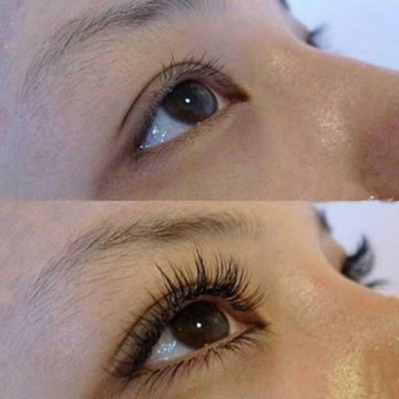 Усилитель ресниц удлинение роста естественная медицина лечение питательные