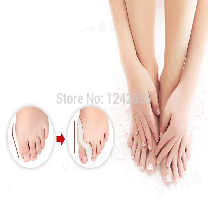 Лидер продаж профессиональный уход за ногами при вальгусной деформации массажер