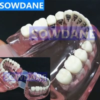 dental orthodontic model with lingual bracket for dentist patient communication study transparent tooth model