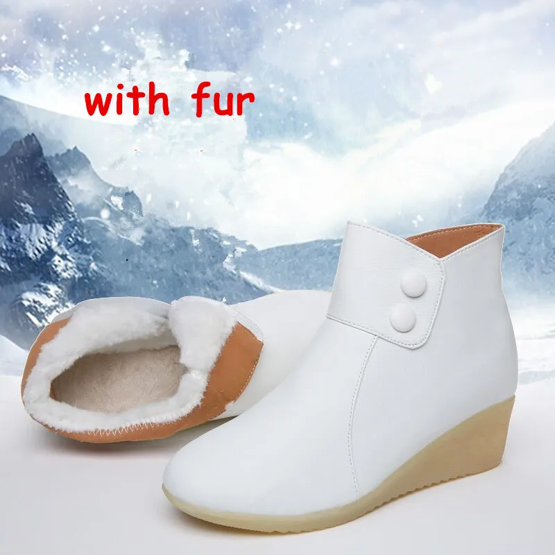 117 white with fur Модные зимние ботинки; женская обувь для медсестры с мехом; коллекция года; Мягкие плюшевые ботильоны из искусственной кожи; женские зимние ботинки на нескользящей платформе; цвет белый - Цвет: 117 white with fur