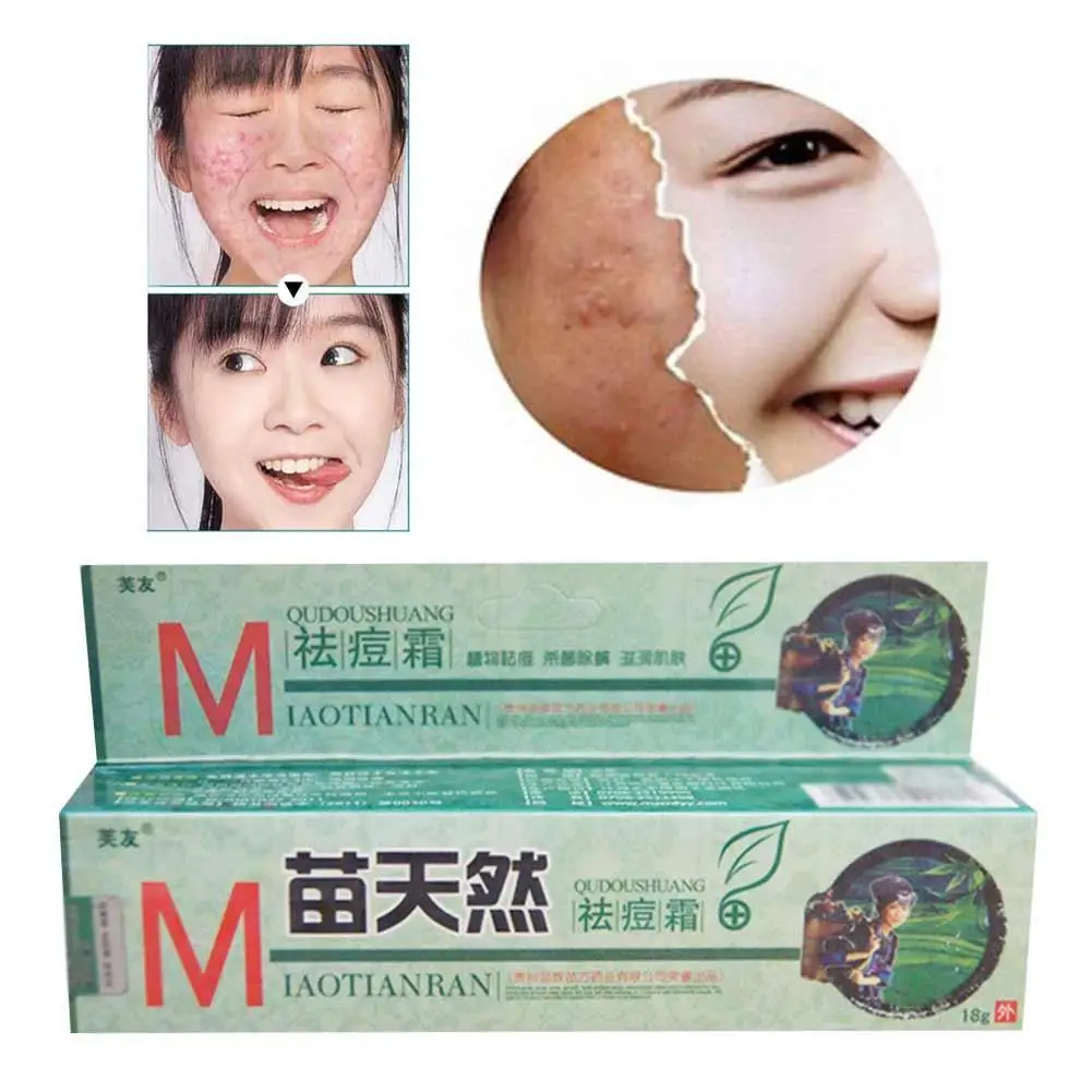 1 шт. натуральный оригинальный бактерицидный крем для удаления клещей