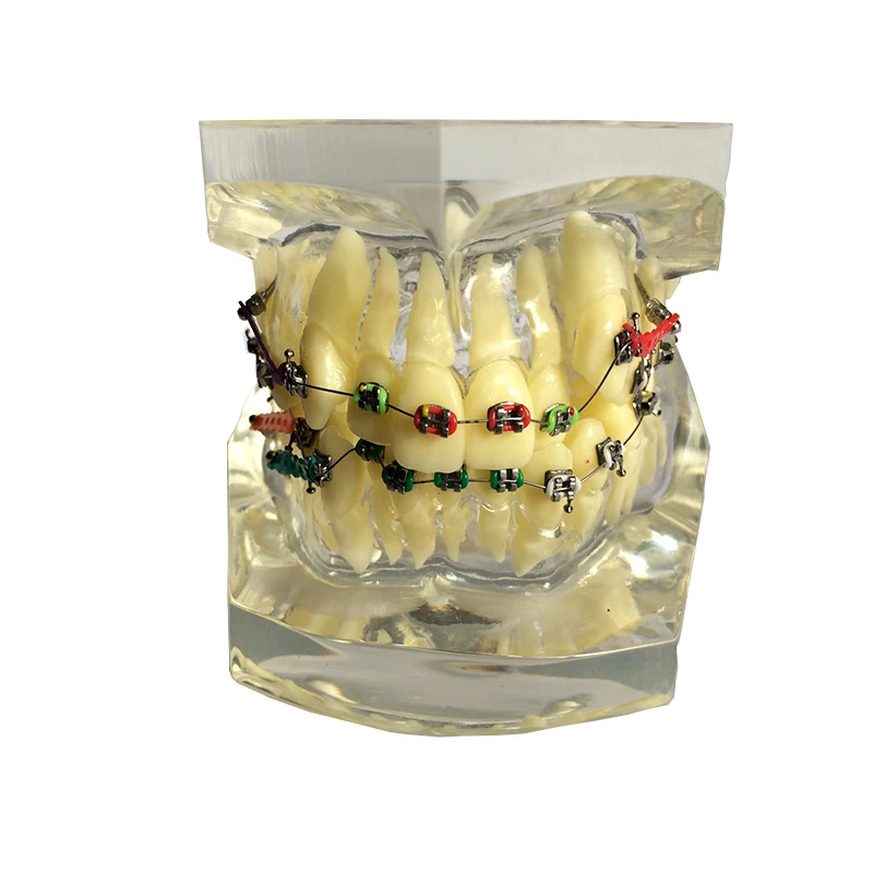 

1 Piece Transparent Dental Tooth Orthodontic Model Malocclusion Models Teaching Model Dentistry Material Dentist Tools